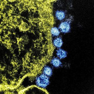 US military photo of the COVID-19 novel coronavirus.